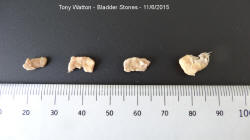 Bladder Stones 11/6/15